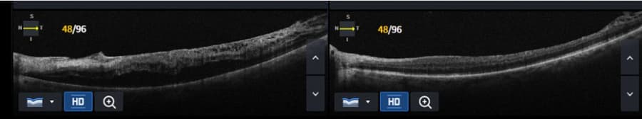 Slider image (8) Dr Nikolaos I Dervenis Eye Clinic